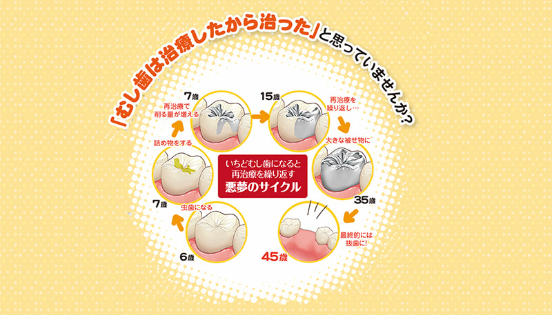 上手にフッ素を使い、虫歯のないこどもに育てましょう！